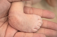 What Can Be Done if My Baby Has Clubfoot?
